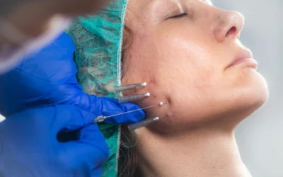 Descubre la Magia del Rejuvenecimiento Facial con Hilos Tensores en La Rodalia Belleza